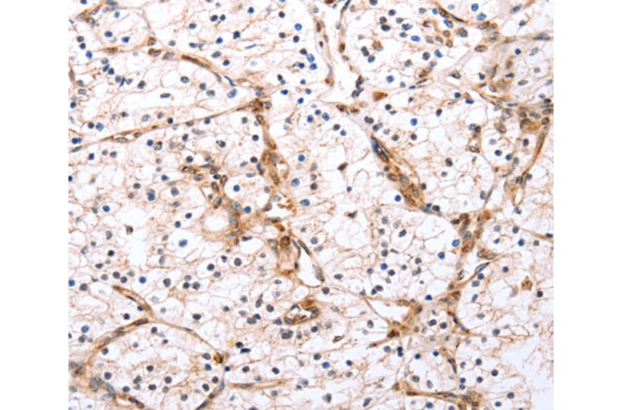 Immunohistochemistry - PDCD10 antibody from Signalway Antibody (38464) - Antibodies.com