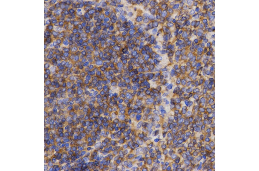Immunohistochemistry - PDCD10 antibody from Signalway Antibody (38464) - Antibodies.com