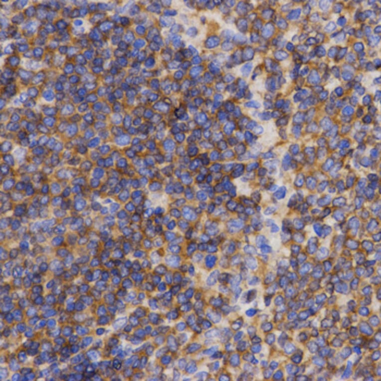 Immunohistochemistry - PDCD10 antibody from Signalway Antibody (38464) - Antibodies.com