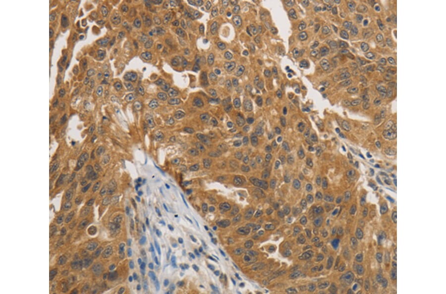 Immunohistochemistry - PTPN11 antibody from Signalway Antibody (38468) - Antibodies.com