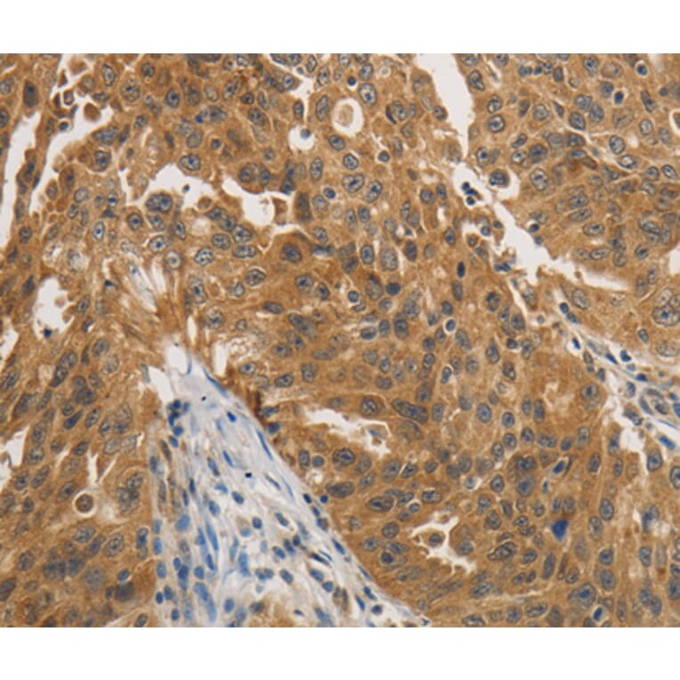 Immunohistochemistry - PTPN11 antibody from Signalway Antibody (38468) - Antibodies.com