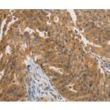 Immunohistochemistry - PTPN11 antibody from Signalway Antibody (38468) - Antibodies.com