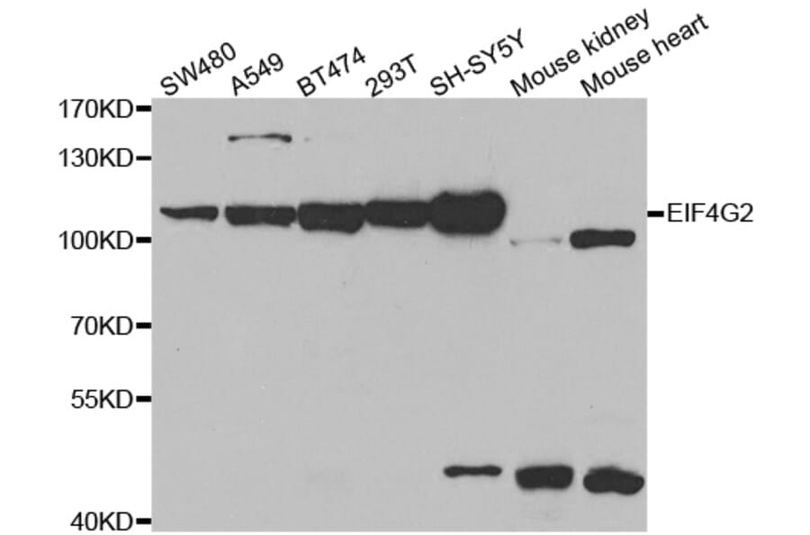 Western blot - EIF4G2 antibody from Signalway Antibody (38486) - Antibodies.com