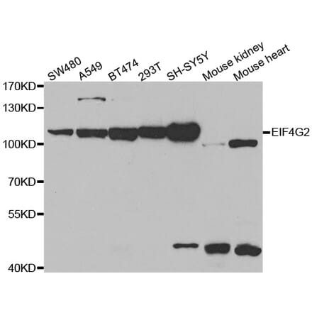 Western blot - EIF4G2 antibody from Signalway Antibody (38486) - Antibodies.com