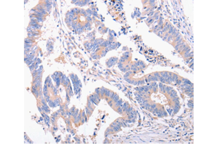 Immunohistochemistry - EIF4G2 antibody from Signalway Antibody (38486) - Antibodies.com