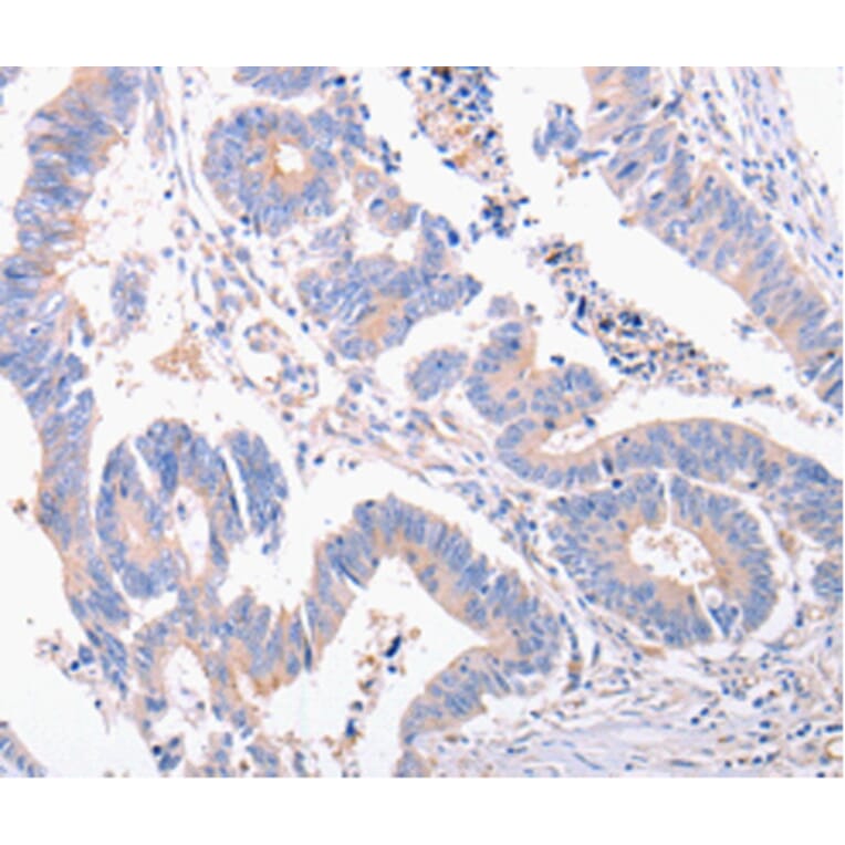 Immunohistochemistry - EIF4G2 antibody from Signalway Antibody (38486) - Antibodies.com