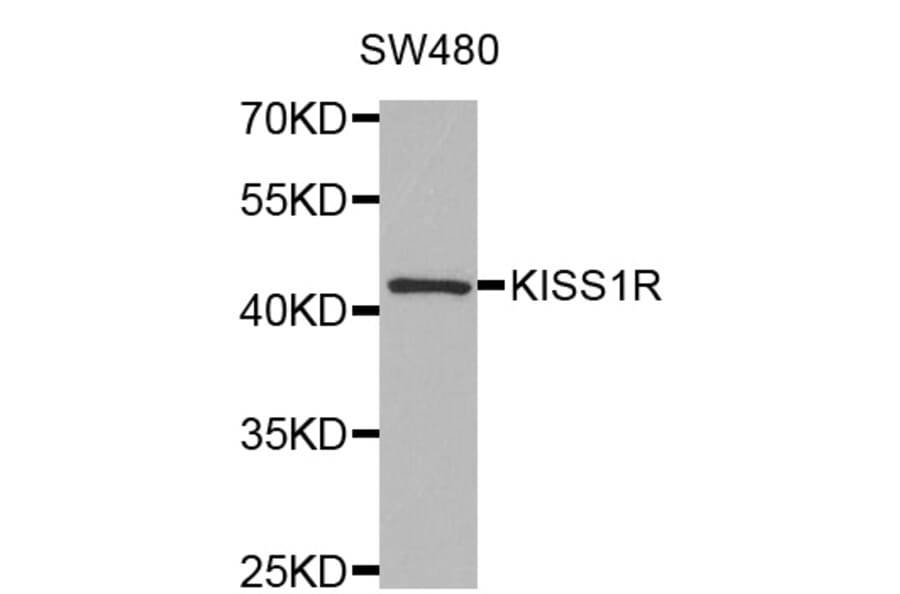Western blot - KISS1R antibody from Signalway Antibody (38513) - Antibodies.com