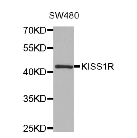 Western blot - KISS1R antibody from Signalway Antibody (38513) - Antibodies.com