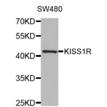 Western blot - KISS1R antibody from Signalway Antibody (38513) - Antibodies.com