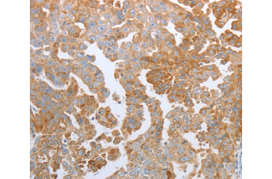 Immunohistochemistry - KISS1R antibody from Signalway Antibody (38513) - Antibodies.com