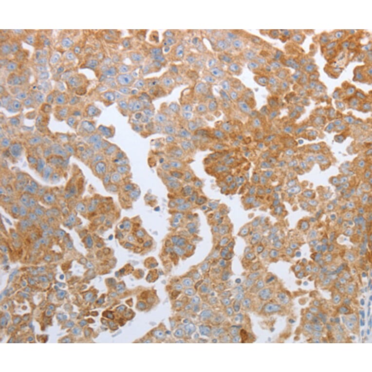 Immunohistochemistry - KISS1R antibody from Signalway Antibody (38513) - Antibodies.com