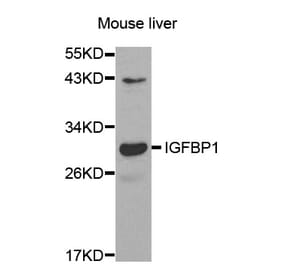 Western blot - IGFBP1 antibody from Signalway Antibody (38521) - Antibodies.com