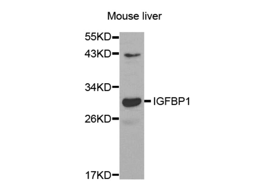 Western blot - IGFBP1 antibody from Signalway Antibody (38521) - Antibodies.com