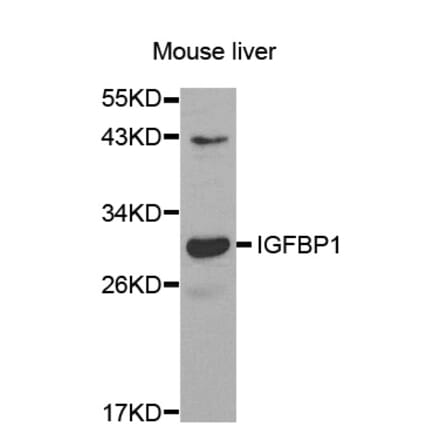 Western blot - IGFBP1 antibody from Signalway Antibody (38521) - Antibodies.com