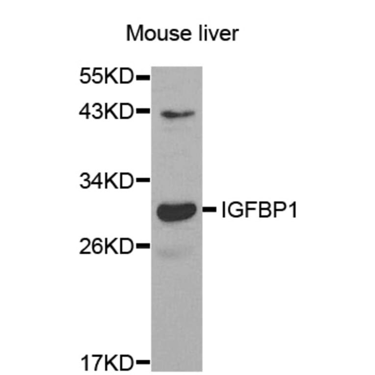 Western blot - IGFBP1 antibody from Signalway Antibody (38521) - Antibodies.com