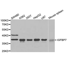 Western blot - IGFBP7 antibody from Signalway Antibody (38522) - Antibodies.com