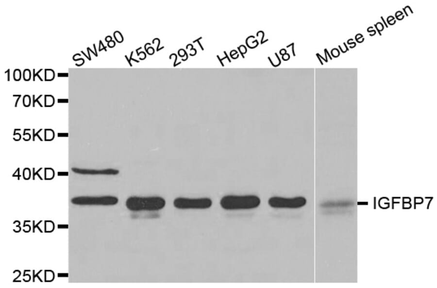 Western blot - IGFBP7 antibody from Signalway Antibody (38522) - Antibodies.com