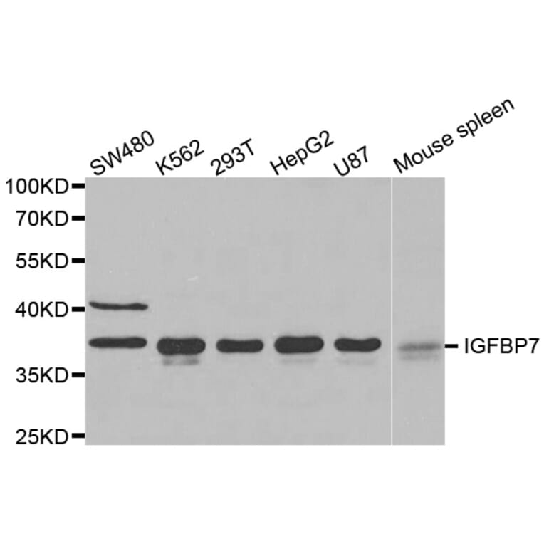 Western blot - IGFBP7 antibody from Signalway Antibody (38522) - Antibodies.com