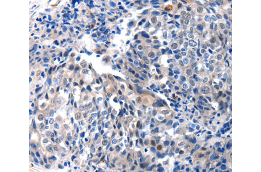 Immunohistochemistry - IGFBP7 antibody from Signalway Antibody (38522) - Antibodies.com