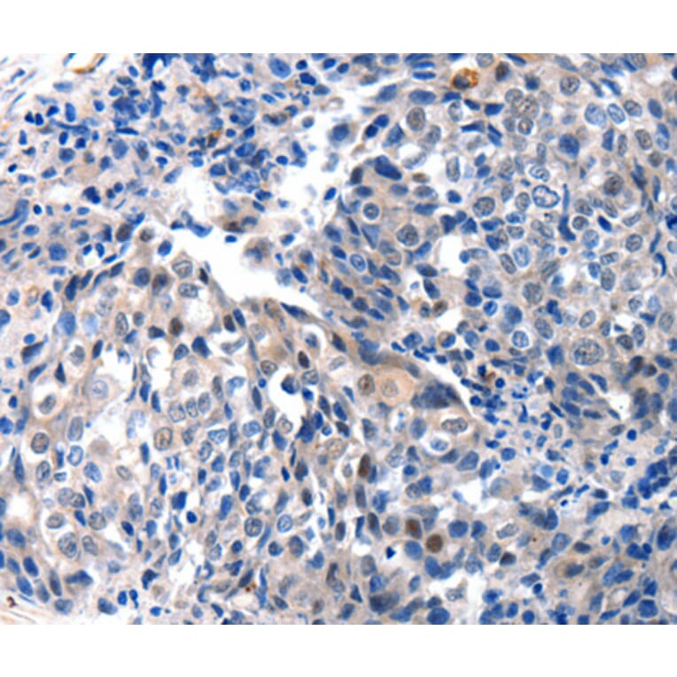 Immunohistochemistry - IGFBP7 antibody from Signalway Antibody (38522) - Antibodies.com