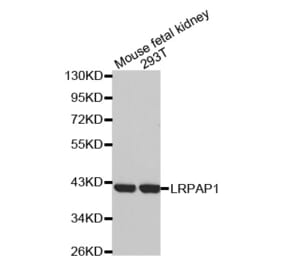 Western blot - LRPAP1 antibody from Signalway Antibody (38532) - Antibodies.com