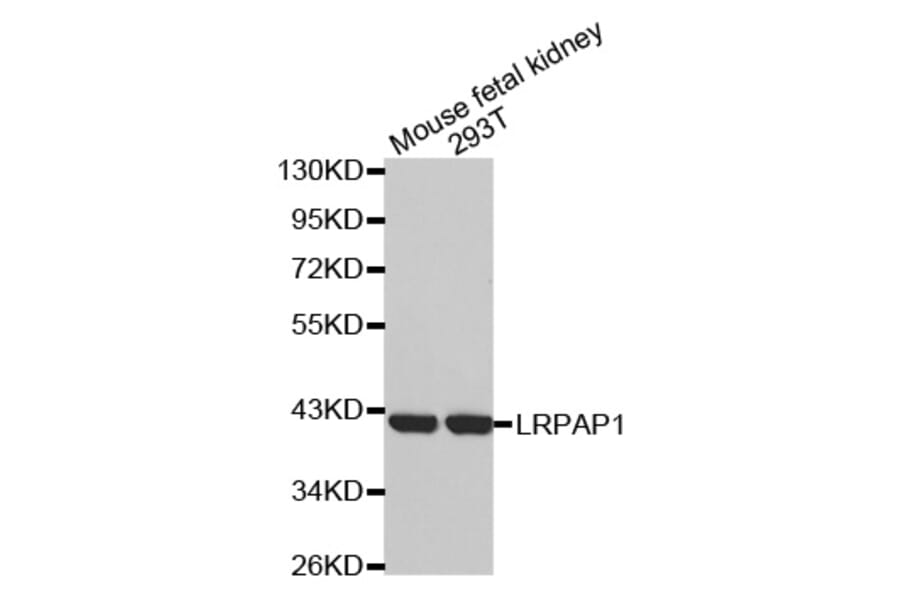 Western blot - LRPAP1 antibody from Signalway Antibody (38532) - Antibodies.com