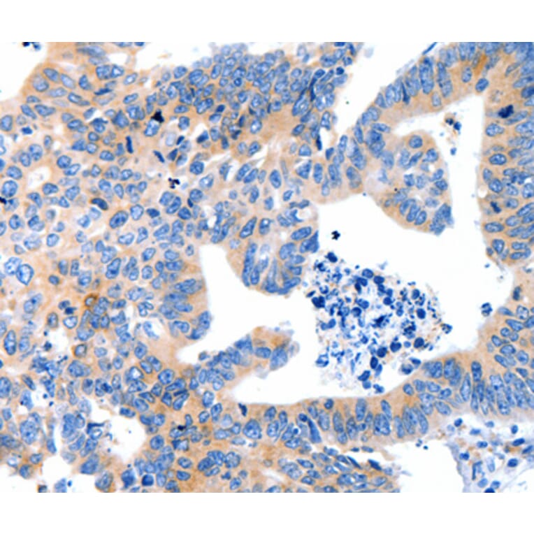 Immunohistochemistry - LRPAP1 antibody from Signalway Antibody (38532) - Antibodies.com