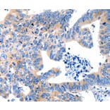 Immunohistochemistry - LRPAP1 antibody from Signalway Antibody (38532) - Antibodies.com