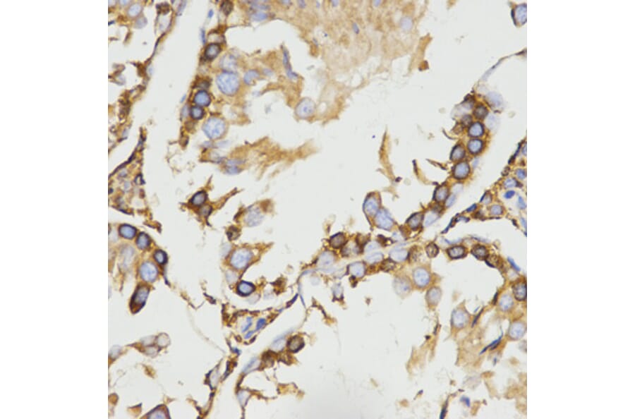 Immunohistochemistry - LRPAP1 antibody from Signalway Antibody (38532) - Antibodies.com