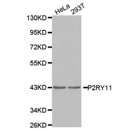 Western blot - P2RY11 antibody from Signalway Antibody (38557) - Antibodies.com
