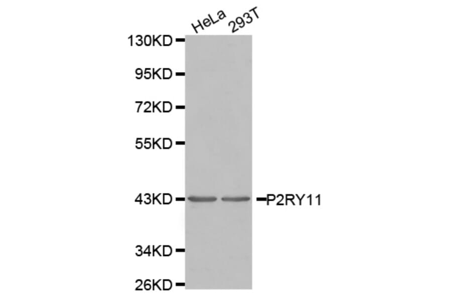 Western blot - P2RY11 antibody from Signalway Antibody (38557) - Antibodies.com