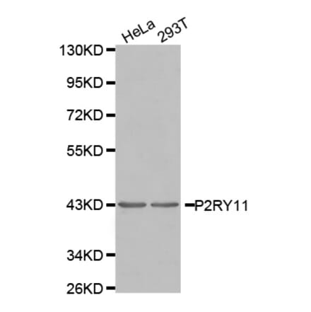 Western blot - P2RY11 antibody from Signalway Antibody (38557) - Antibodies.com