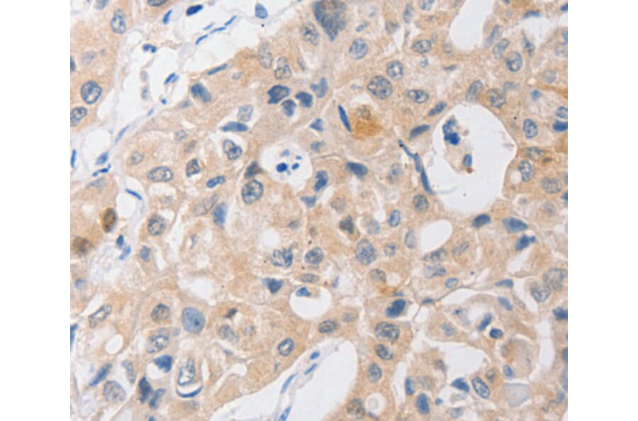 Immunohistochemistry - P2RY11 antibody from Signalway Antibody (38557) - Antibodies.com