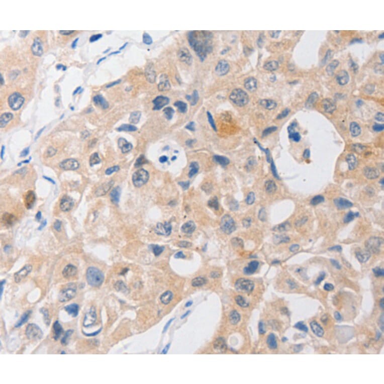 Immunohistochemistry - P2RY11 antibody from Signalway Antibody (38557) - Antibodies.com