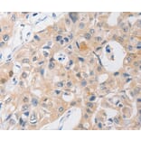 Immunohistochemistry - P2RY11 antibody from Signalway Antibody (38557) - Antibodies.com