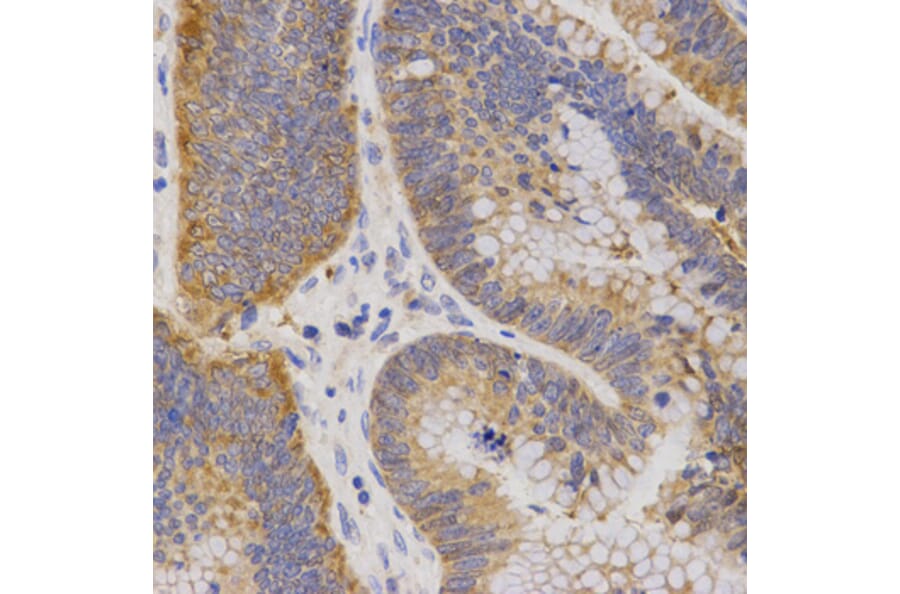 Immunohistochemistry - P2RY11 antibody from Signalway Antibody (38557) - Antibodies.com