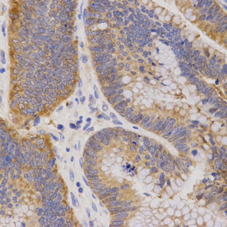 Immunohistochemistry - P2RY11 antibody from Signalway Antibody (38557) - Antibodies.com