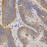 Immunohistochemistry - P2RY11 antibody from Signalway Antibody (38557) - Antibodies.com