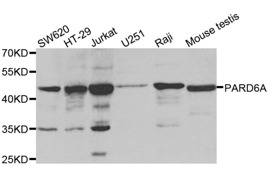 Western blot - PARD6A antibody from Signalway Antibody (38559) - Antibodies.com