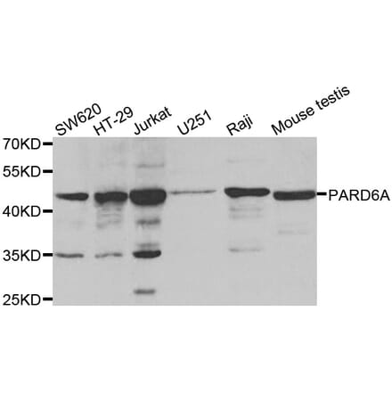 Western blot - PARD6A antibody from Signalway Antibody (38559) - Antibodies.com