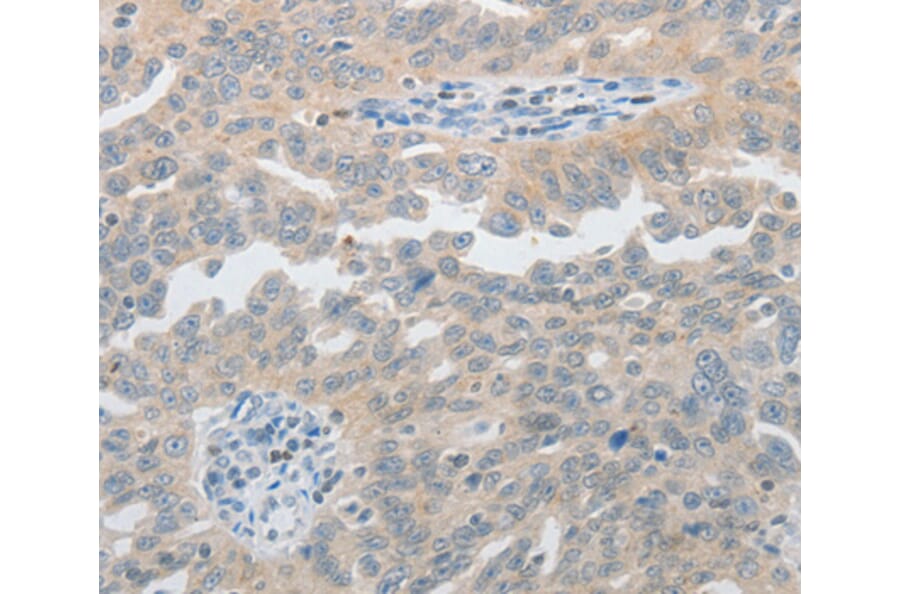 Immunohistochemistry - PIWIL2 antibody from Signalway Antibody (38565) - Antibodies.com
