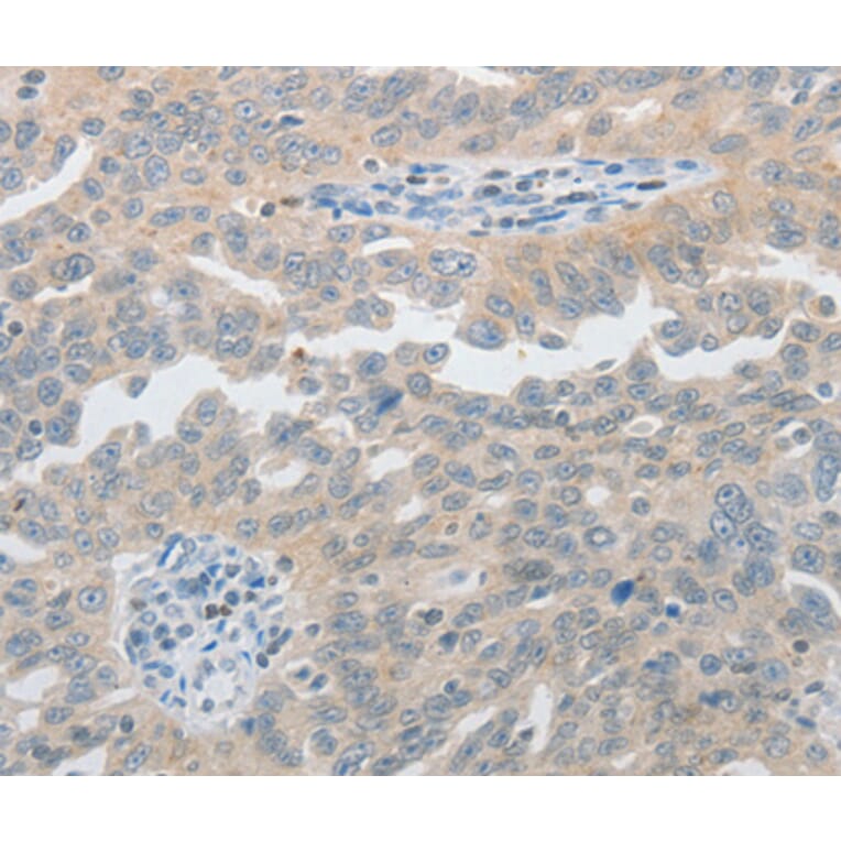 Immunohistochemistry - PIWIL2 antibody from Signalway Antibody (38565) - Antibodies.com