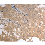 Immunohistochemistry - SLC1A4 antibody from Signalway Antibody (38571) - Antibodies.com