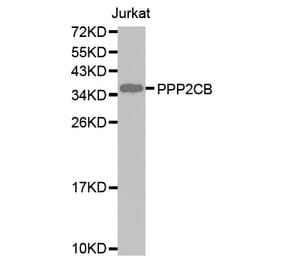 Western blot - PPP2CB antibody from Signalway Antibody (38593) - Antibodies.com