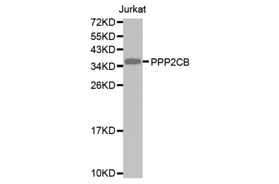 Western blot - PPP2CB antibody from Signalway Antibody (38593) - Antibodies.com