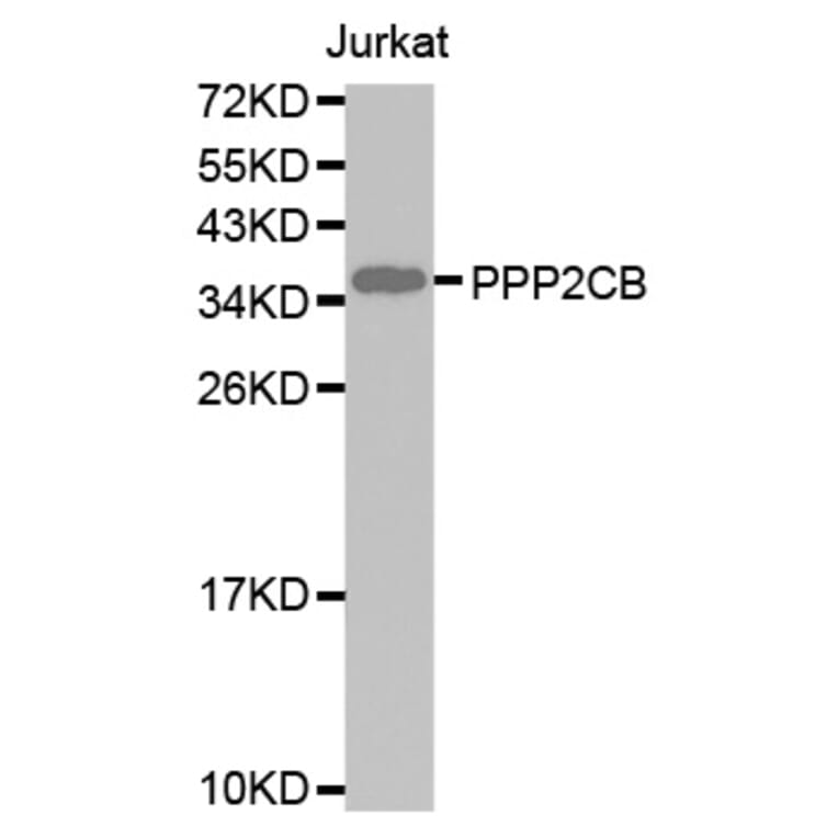 Western blot - PPP2CB antibody from Signalway Antibody (38593) - Antibodies.com