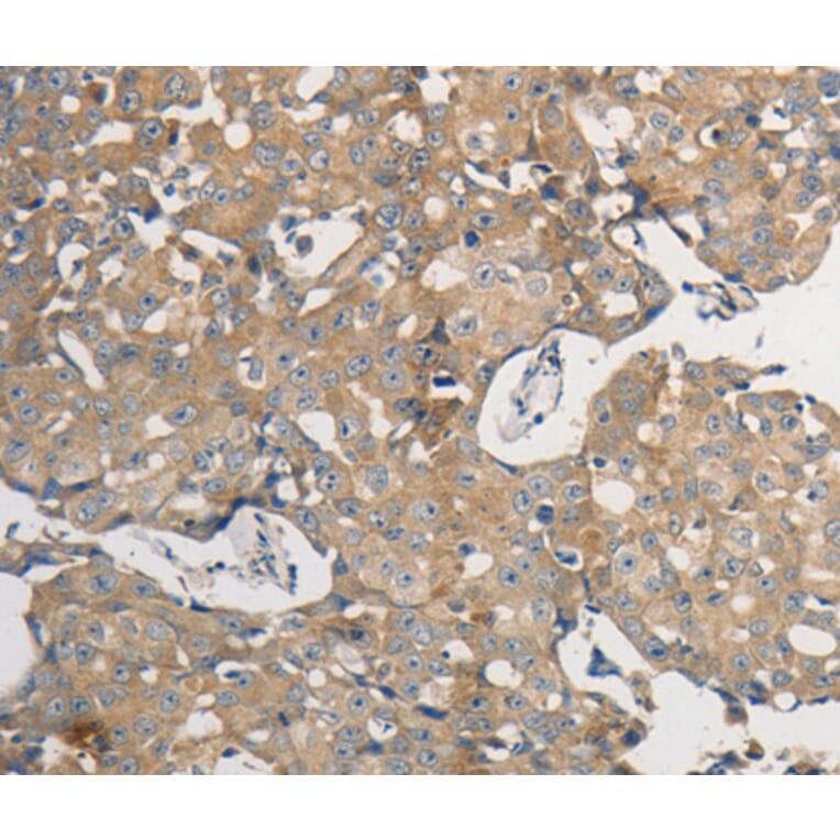Immunohistochemistry - PPP2CB antibody from Signalway Antibody (38593) - Antibodies.com