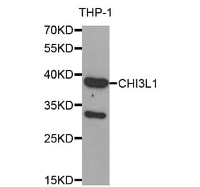 Western blot - CHI3L1 antibody from Signalway Antibody (38608) - Antibodies.com