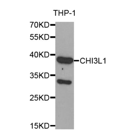 Western blot - CHI3L1 antibody from Signalway Antibody (38608) - Antibodies.com
