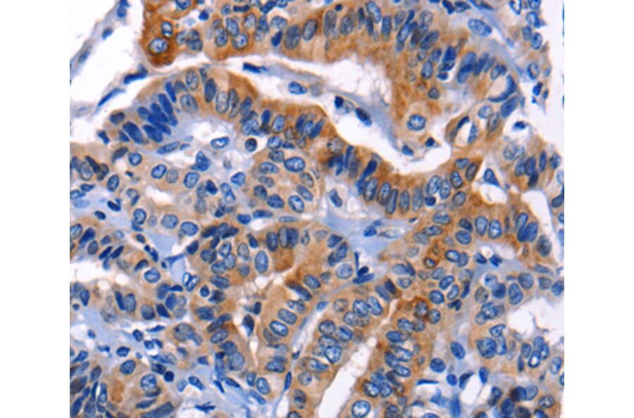 Immunohistochemistry - CHI3L1 antibody from Signalway Antibody (38608) - Antibodies.com